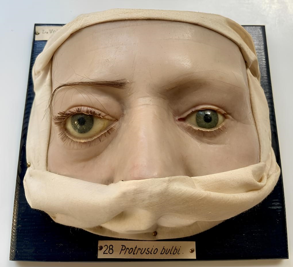 Top des loisirs qui font peur en Suisse - Moulagenmuseum de Zurich